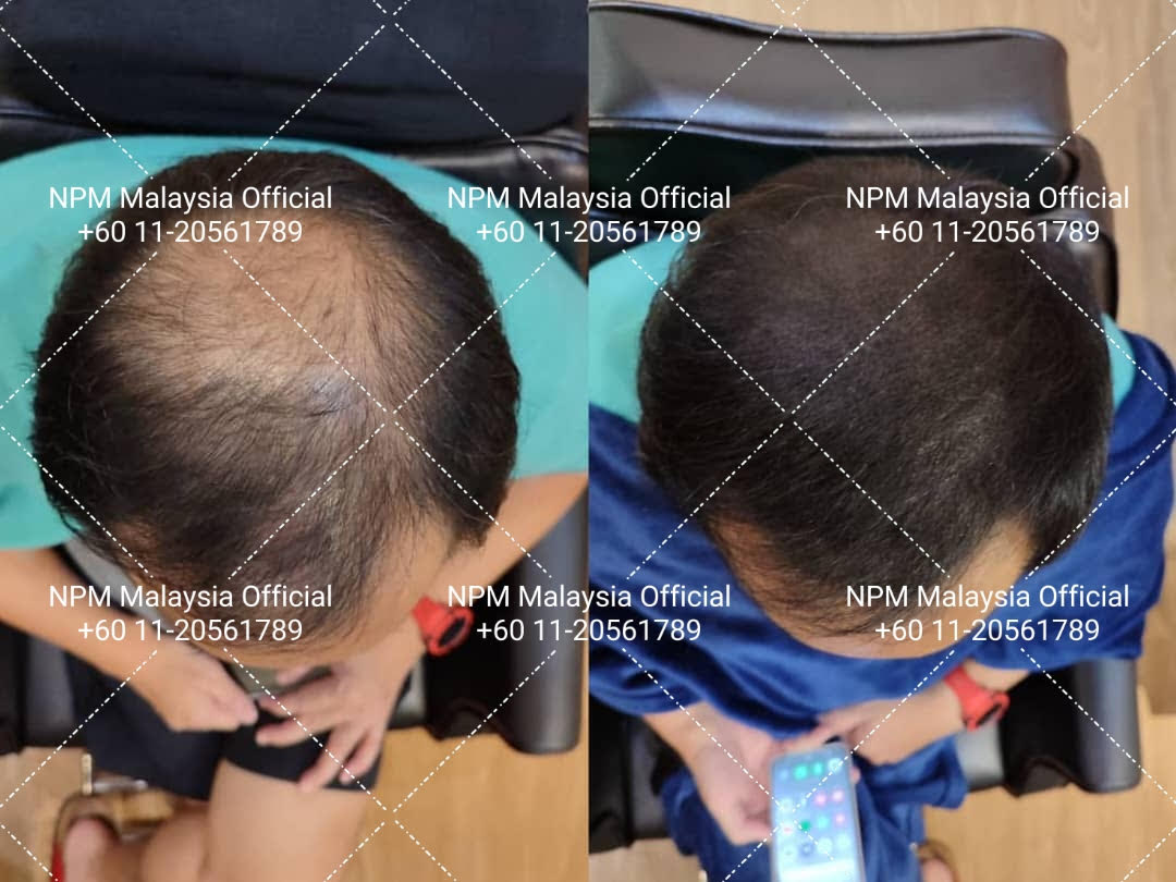 Comprehensive hair restoration