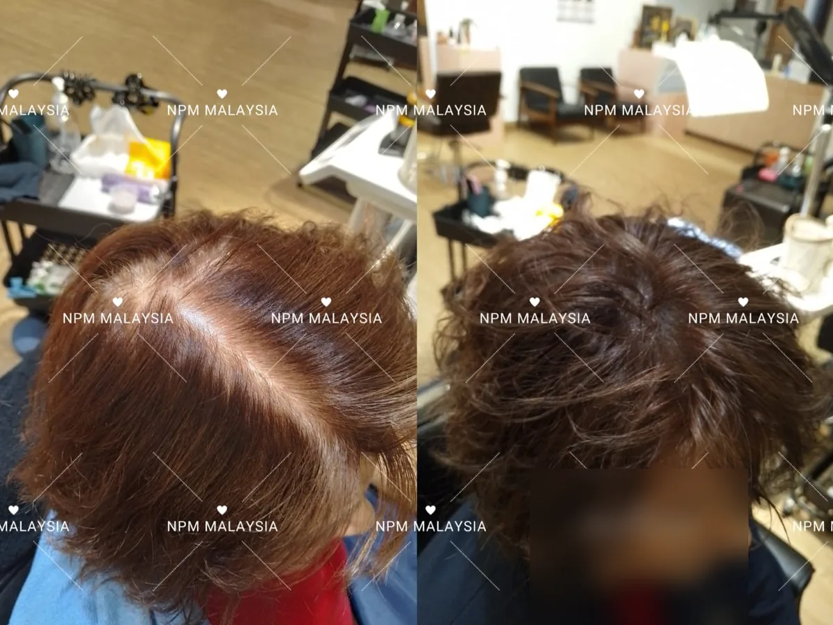 NPM顾客拟发生发前后对比
