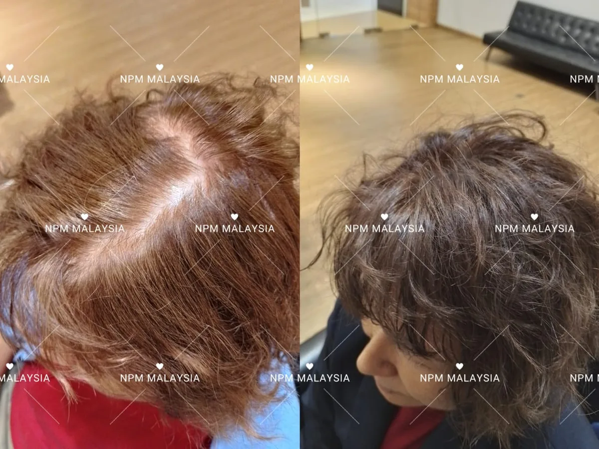 NPM customer before and after Simulation & Stimulation