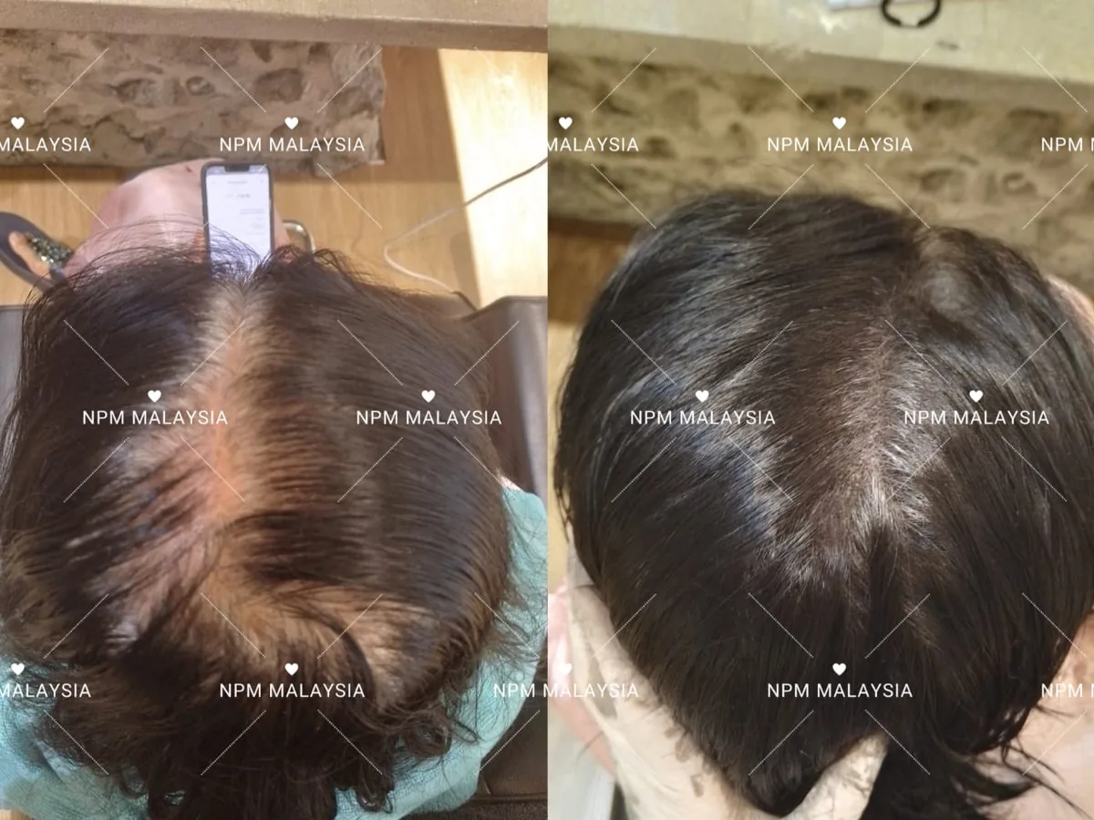 NPM顾客拟发生发前后对比