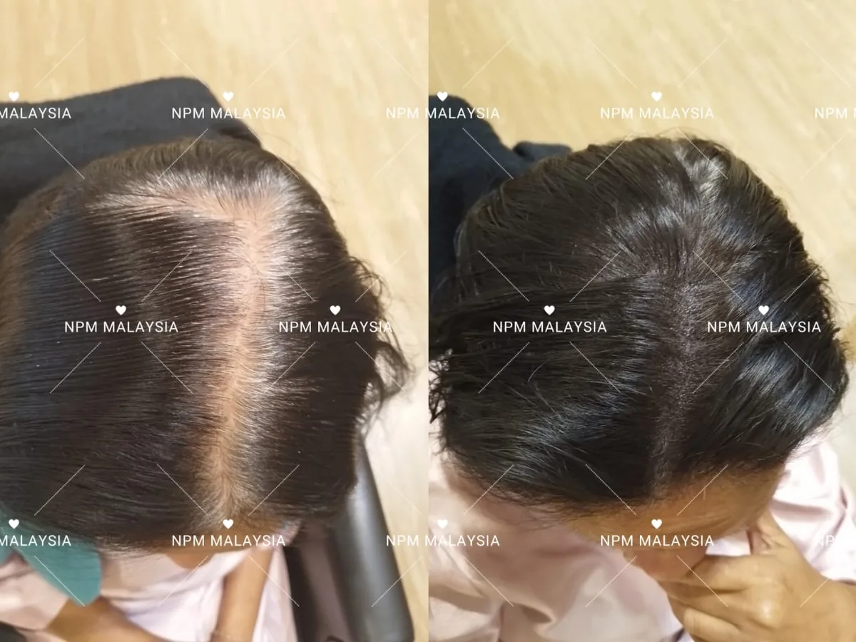 NPM customer before and after Simulation & Stimulation