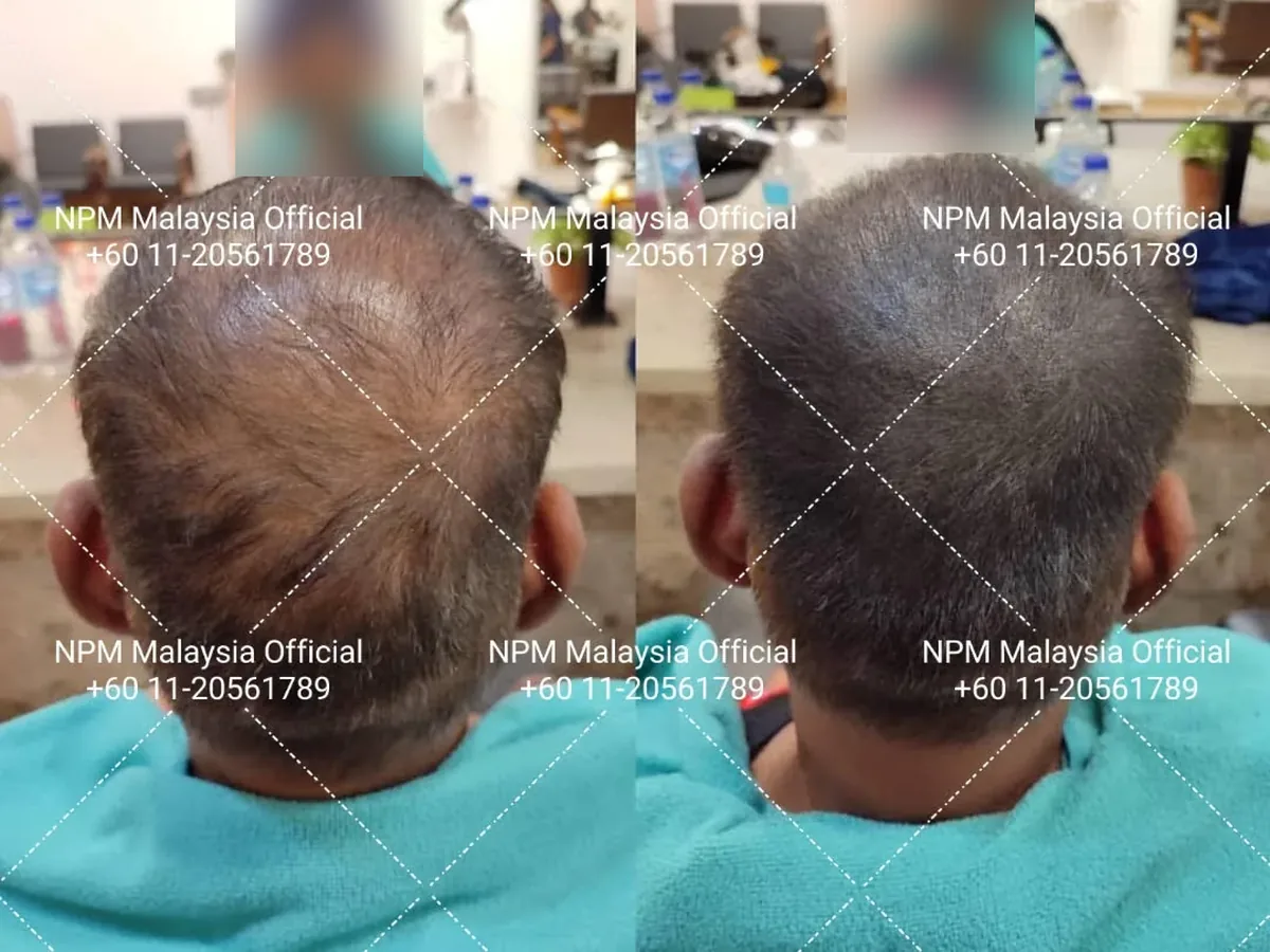Sebelum dan selepas Simulasi & Stimulasi pelanggan NPM